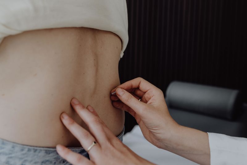 Dr. med Rieke Hermann setzt eine Akupunkturnadel in den Rücken einer Patientin.